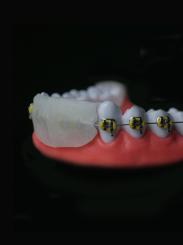 Omniguard Protège-dents  